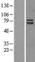 TRIM32 Human Over-expression Lysates NM_001099679