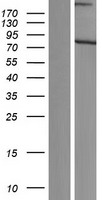 SCMH1 Human Over-expression Lysates NM_001172220