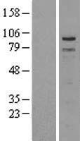 TPX2 Human Over-expression Lysates NM_012112