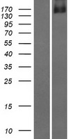 DIP2C Human Over-expression Lysates NM_014974