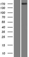 ls022983 mast1 human over expression lysates nm 014975 wb testing 1