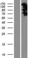 LIMCH1 Human Over-expression Lysates NM_014988