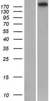 RIM1 (RIMS1) Human Over-expression Lysates NM_014989