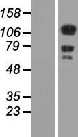DAAM1 Human Over-expression Lysates NM_014992