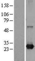 ls023011 rab21 human over expression lysates nm 014999 wb testing 1