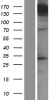 UNC13A Human Over-expression Lysates NM_001080421