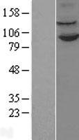 ls023028 kdm1a human over expression lysates nm 015013 wb testing 2