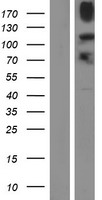 KDM4B Human Over-expression Lysates NM_015015