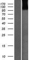 USP33 Human Over-expression Lysates NM_201624