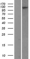 RanBP16 (XPO7) Human Over-expression Lysates NM_015024