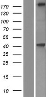 KIF21B Human Over-expression Lysates NM_017596