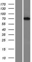 FBP17 (FNBP1) Human Over-expression Lysates NM_015033