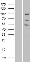 ENDOD1 Human Over-expression Lysates NM_015036