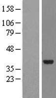NMNAT2 Human Over-expression Lysates NM_170706