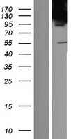 ls023066 tip120b cand2 human over expression lysates nm 001162499 wb testing 1