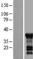ls023089 peg10 human over expression lysates nm 001040152 wb testing 1
