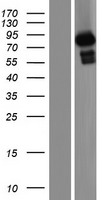 GRAF (ARHGAP26) Human Over-expression Lysates NM_001135608