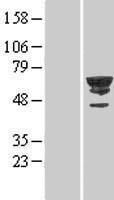 CDC2L6 (CDK19) Human Over-expression Lysates NM_015076