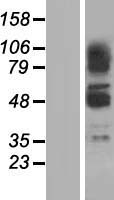 ZBTB43 Human Over-expression Lysates NM_014007