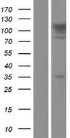 ls023102 tbc1d2b human over expression lysates nm 144572 wb testing 1