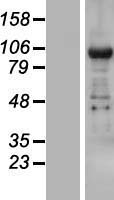 ls023112 tnrc6b human over expression lysates nm 001024843 wb testing 1
