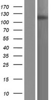 ls023133 phf8 human over expression lysates nm 001184896 wb testing 1