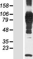 N4BP3 Human Over-expression Lysates NM_015111