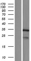 DCUN1D4 Human Over-expression Lysates NM_015115