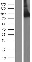 ls023154 neurochondrin ncdn human over expression lysates nm 001014839 wb testing 1