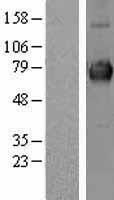 CLCC1 Human Over-expression Lysates NM_015127