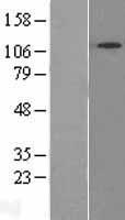 SNX13 Human Over-expression Lysates NM_015132