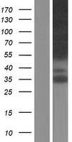 MPRIP Human Over-expression Lysates NM_201274