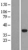 GPD1L Human Over-expression Lysates NM_015141