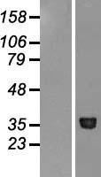 Methionyl Aminopeptidase 1 (METAP1) Human Over-expression Lysates NM_015143