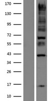ANKRD15 (KANK1) Human Over-expression Lysates NM_153186