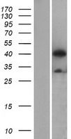 ls023192 atg4b human over expression lysates nm 178326 wb testing 3