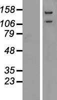 alpha Glucosidase II (GANAB) Human Over-expression Lysates NM_198334