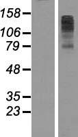 FBXL7 Human Over-expression Lysates NM_012304