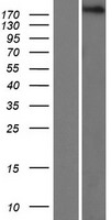 Proteasome Activator Subunit 4 (PSME4) Human Over-expression Lysates NM_014614
