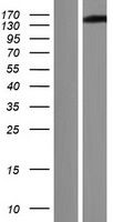 GSE1 Human Over-expression Lysates NM_014615