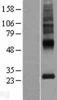 MLC1 Human Over-expression Lysates NM_015166