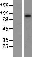 Sulfatase 1 (SULF1) Human Over-expression Lysates NM_015170