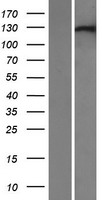 XPO6 Human Over-expression Lysates NM_015171