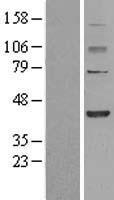 FBXO28 Human Over-expression Lysates NM_015176