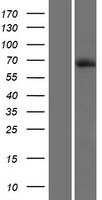 DTX4 Human Over-expression Lysates NM_015177