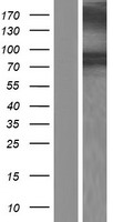 ls023221 dbc2 rhobtb2 human over expression lysates nm 001160037 wb testing 1