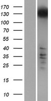 RRP12 Human Over-expression Lysates NM_001145114