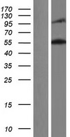 Nesprin 2 (SYNE2) Human Over-expression Lysates NM_182910