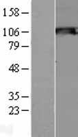 Snf1lk2 (SIK2) Human Over-expression Lysates NM_015191