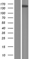 ATP11A Human Over-expression Lysates NM_032189